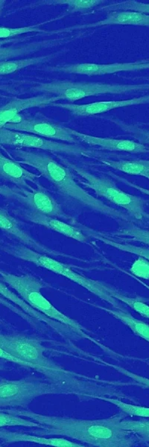 Knock-in-Immortalized-Cell-Lines.webp