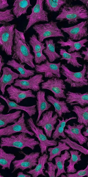 national-cancer-institute-c-wqrSCjVf4-unsplash-1-scaled.webp