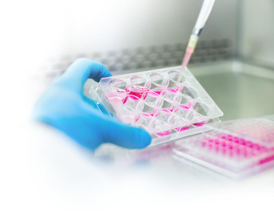 Parse CRISPR detect