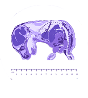 Spatially resolved transcriptomic profiling