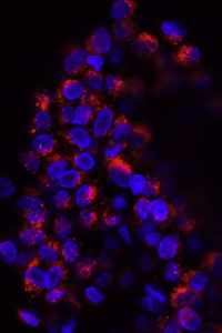 Knockout iPS Cells